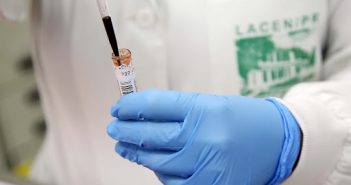 Coronavírus: Brasil tem ao menos 23 mil testes aguardando resultado