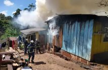 Bebê de 6 meses tem 70% do corpo queimado em incêndio no PR