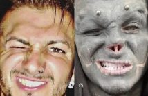 Homem quer amputar uma das pernas para se parecer com alienígena