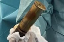 Homem faz hospital ser evacuado ao chegar no local com bomba no ânus